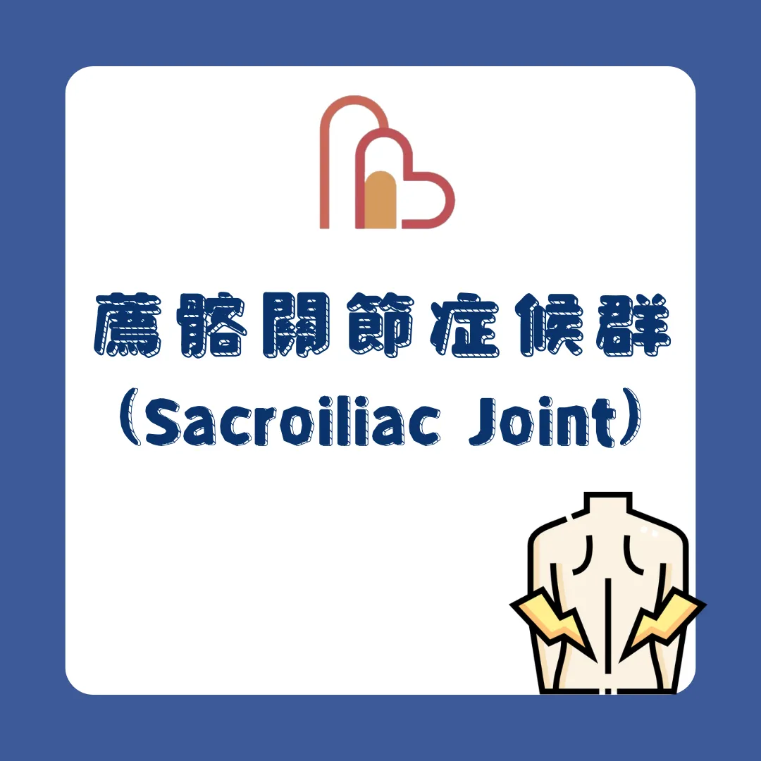 薦髂關節症候群 (Sacroiliac joint syndrome)